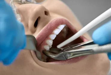 Chirurgia stomatologiczna